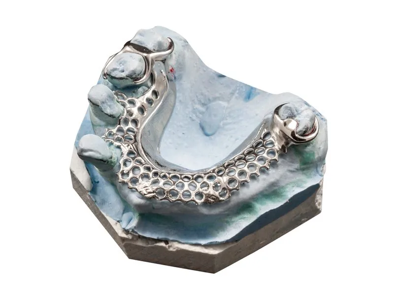 Titanium framework partial denture dental lab Sydney